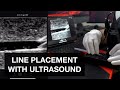 Ultrasound-Guided IV Placement