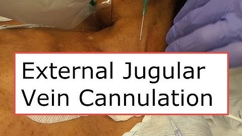 External Jugular Vein Cannulation