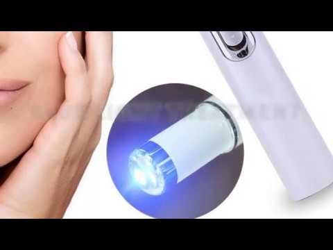 Remove Acne with Acne Treatment laser Pen / Safe, Effective and Dermatologist-Recommended