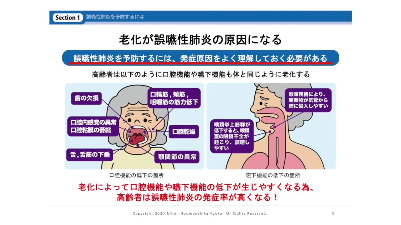 訪問歯科診療 食介護の知識と実践 訪問歯科診療 食介護の知識と実践 Amazon.co.jp: よくわかる歯科訪問