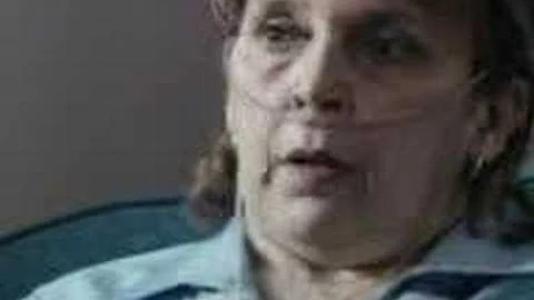 Smoking: Janice