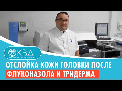 👉 Отслойка кожи головки после флуконазола и тридерма. Клинический случай №835