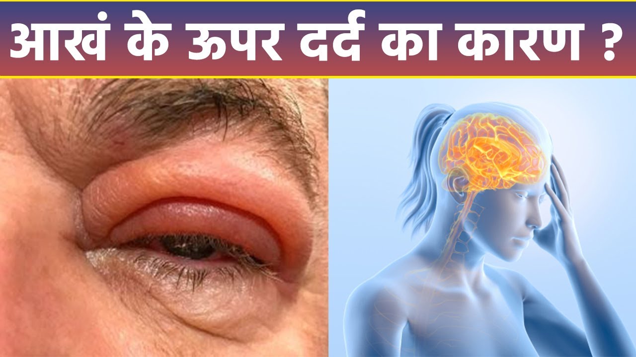 Aankh Ke Upar Dard Kyu Hota Hai aankh-ke-upar-dard-kyu-hota-hai