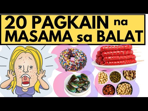 20 PAGKAIN na MASAMA sa BALAT at dapat mong nang IWASAN | Foods that are BAD for the SKIN