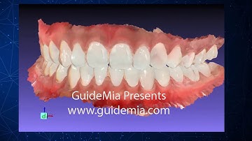 digital orthodontics with guidemia presentation EN