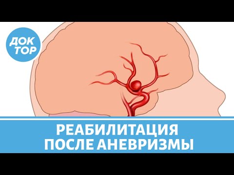 Аневризма головного мозга: как вернуть психическое здоровье?