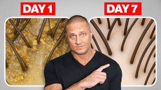 Desintoxicação capilar de 7 dias para SALVAR seu cabelo