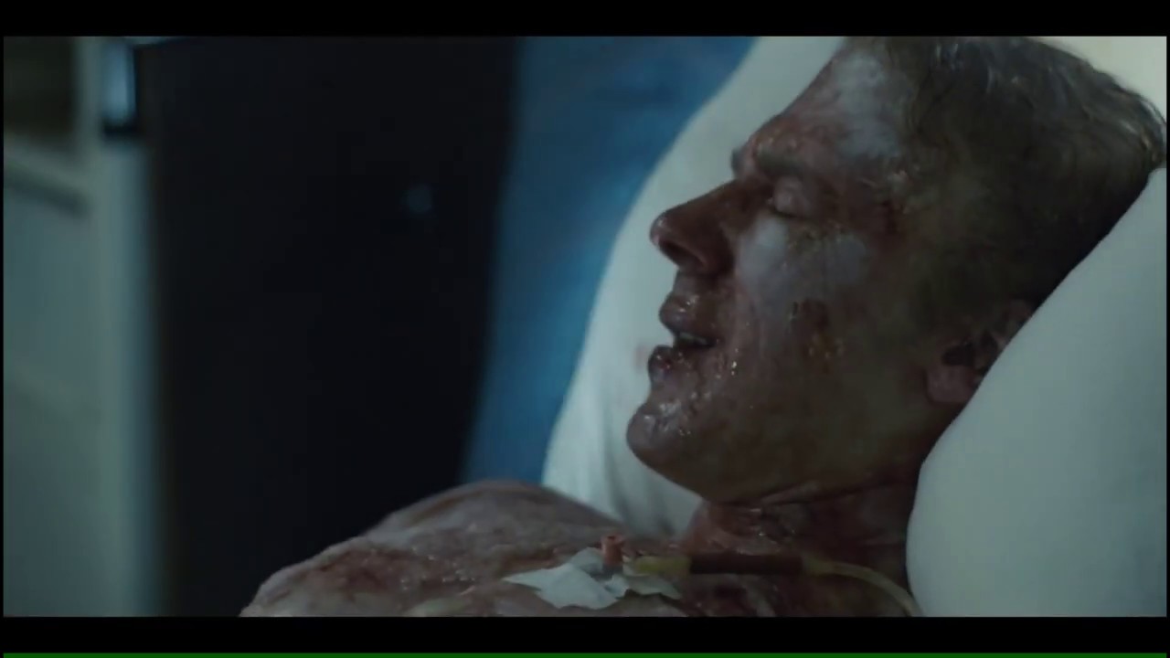 Chernobyl (2019) - Lyudmilla Ignatenko and her husband Vasily last moments scene