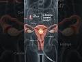 is embryo transfer painful
