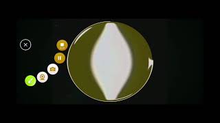 Lg Logo 1995 In Too Ruins Tree Squared