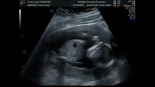 Liam Jacob 17w3d