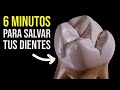 ¿Cómo salvar tus dientes de la caries más peligrosa? En 6 minutos te explico.