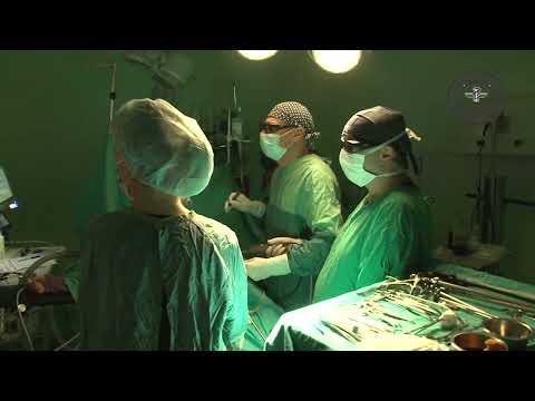 Operatii laparoscopice 3D-HD la Spitalul CF Timisoara