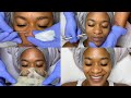 Double Exfoliation Facial w/ Microdermabrasion | GlamByLiaLeigh