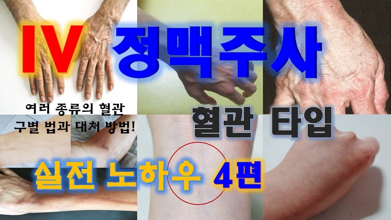 9. IV 정맥주사 놓는법 4편 혈관타입 - IV nurse 경험자의 실전 노하우.