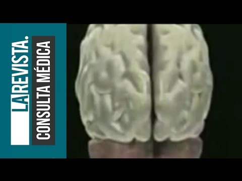 Vídeo: Los Efectos De La Epilepsia En El Cuerpo