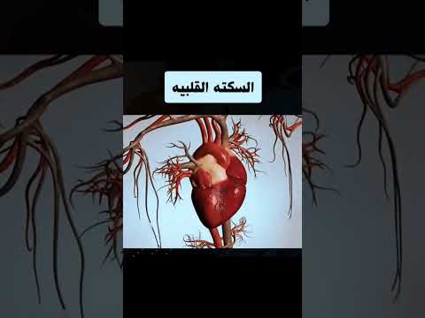 السكته القلبية