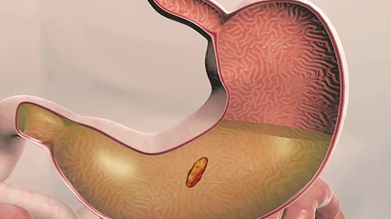 Was ist der Zusammenhang zwischen Diabetes und Juckreiz