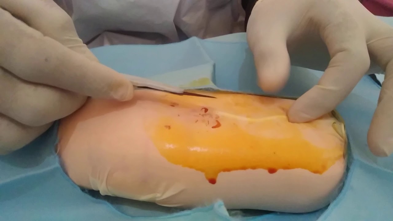 Tutorial 3 tehnik pencabutan impan