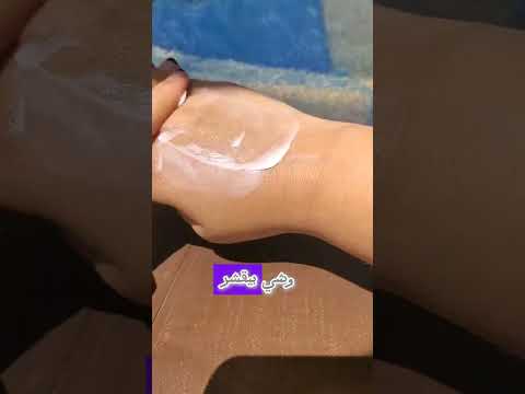 لقيت الحل لعلاج اسمرار المصيف 