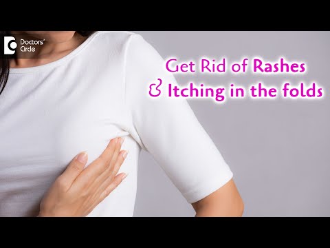 Rashes below breast fold | Remedies to Avoid itching under folds-Dr. Rajdeep Mysore| Doctors' Circle