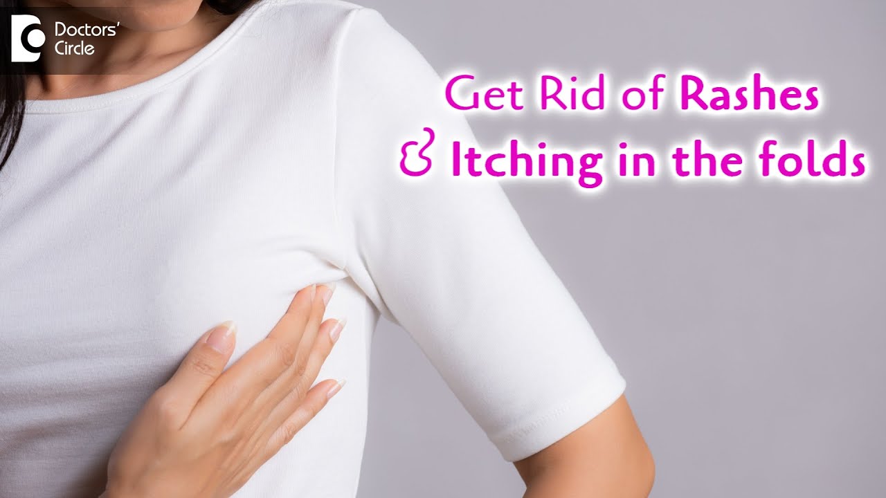 Rashes below breast fold, Remedies to Avoid itching under folds-Dr.  Rajdeep Mysore