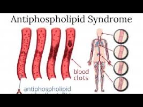 IMMUNOLOGY - APS - LEC 5 *part 2* - YouTube