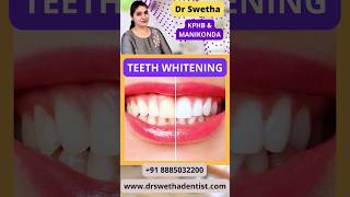 #TeethWhitening | Dr Swetha | Best Dentist | Best Dental Clinic in Hyderabad | Kukatpally