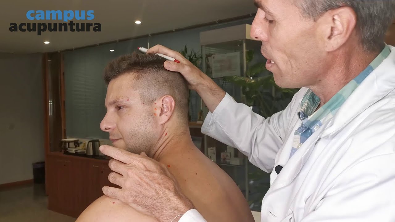 Punto x punto: Meridiano de Triple Recalentador / San Jiao - Prof. Raúl Ucieza | Campus Acupuntura