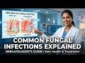 Fungal Infections Getting Worse—Here's What's Happening