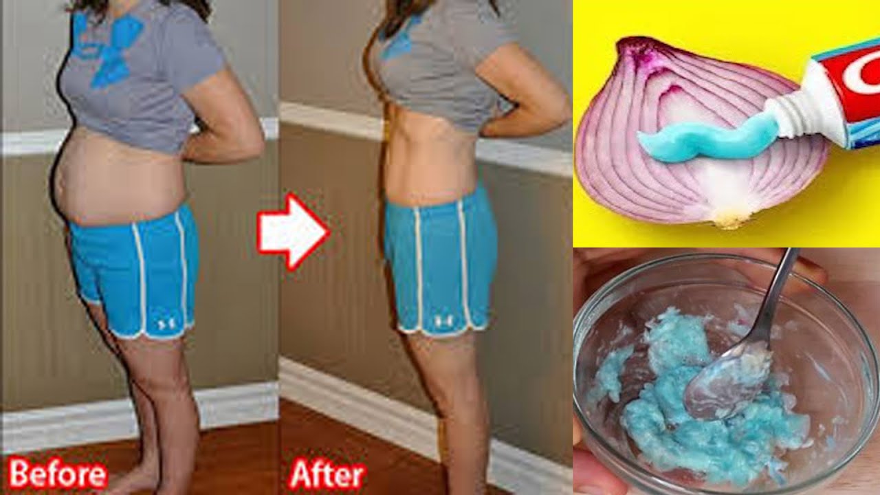 NO EXERCISE NO DIET LOSS BELLY FAT IN JUST 7 DAYS AT HOME | MAGICAL