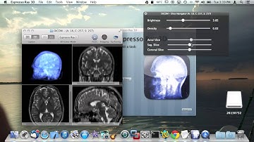 Loading images from a DICOM CD