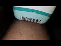 Actual Hair removal by epilator view from the other side #Epilator #SlowMotion