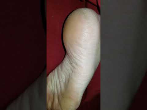 wife sleepy feet !