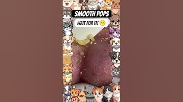 Wow! #pimplepopping #pimple #pimples #youtubeshorts #youtube #shortsfeed #shortvideo #shorts #short