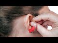 Wie legt man ein Hinter-dem-Ohr-Hörgerät (HdO) an?