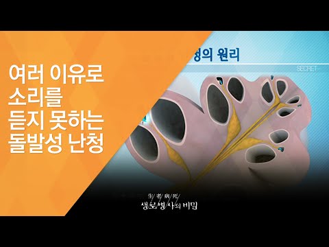 여러 이유로 소리를 듣지 못하는 돌발성 난청 - (20150617_548회 방송)_소리 없는 아우성, 귀(耳)의 비밀