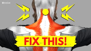 How to Fix a Snapping and Popping Neck