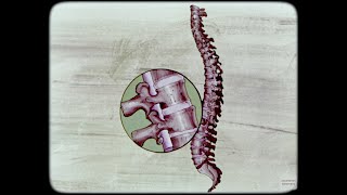 'The Backbone' goofy 1974 filmstrip about the spine