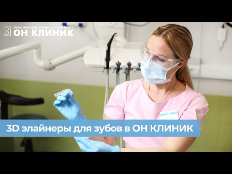 3D элайнеры для зубов в ОН КЛИНИК.