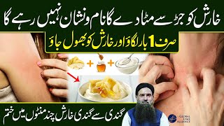 Kharish/Karis Ka Fori ilaj || How to Remove itching from Body || Dr Sharafat Ali