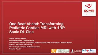 Rapid, high fidelity cardiac MR in adult and pediatric patients powered by Sonic DL
