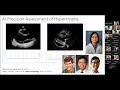 Real-World AI Series: Precision Identification of Cardiac Amyloidosis in Diverse Population
