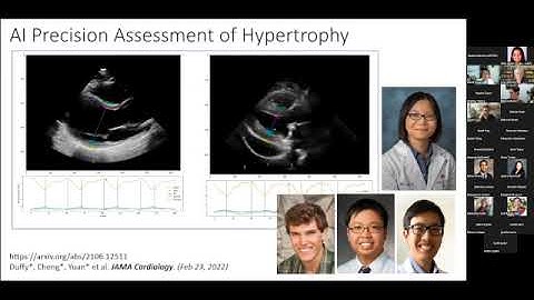 Real-World AI Series: Precision Identification of Cardiac Amyloidosis in Diverse Population