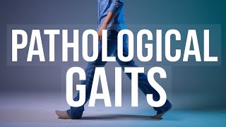 10 Pathological Gaits Explained! | Causes, Symptoms, and Phases of Gait Analysis | #bhpiposchool