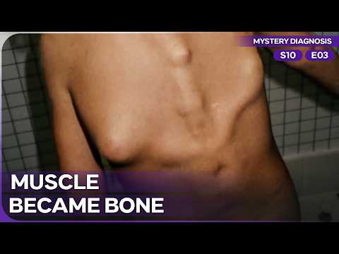 A Second Skeleton Growing Inside His Body | Mystery Diagnosis