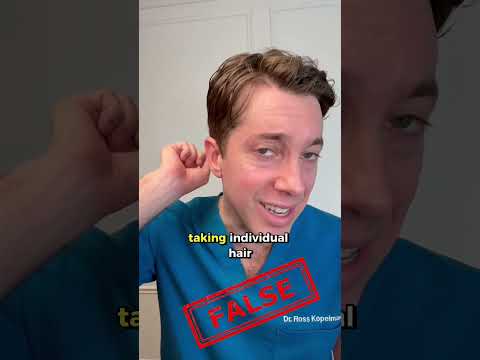 Do Hair Transplants