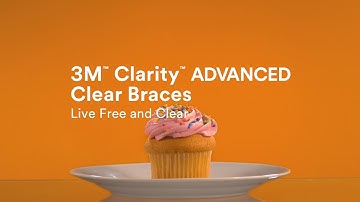 3M Clarity Advanced Ceramic Brackets- Coming Together