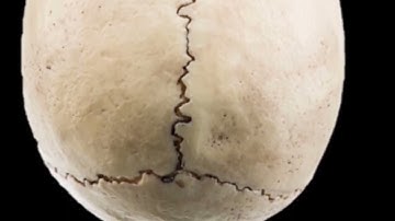 Skull Sutures - Bones of the Skull Short Version