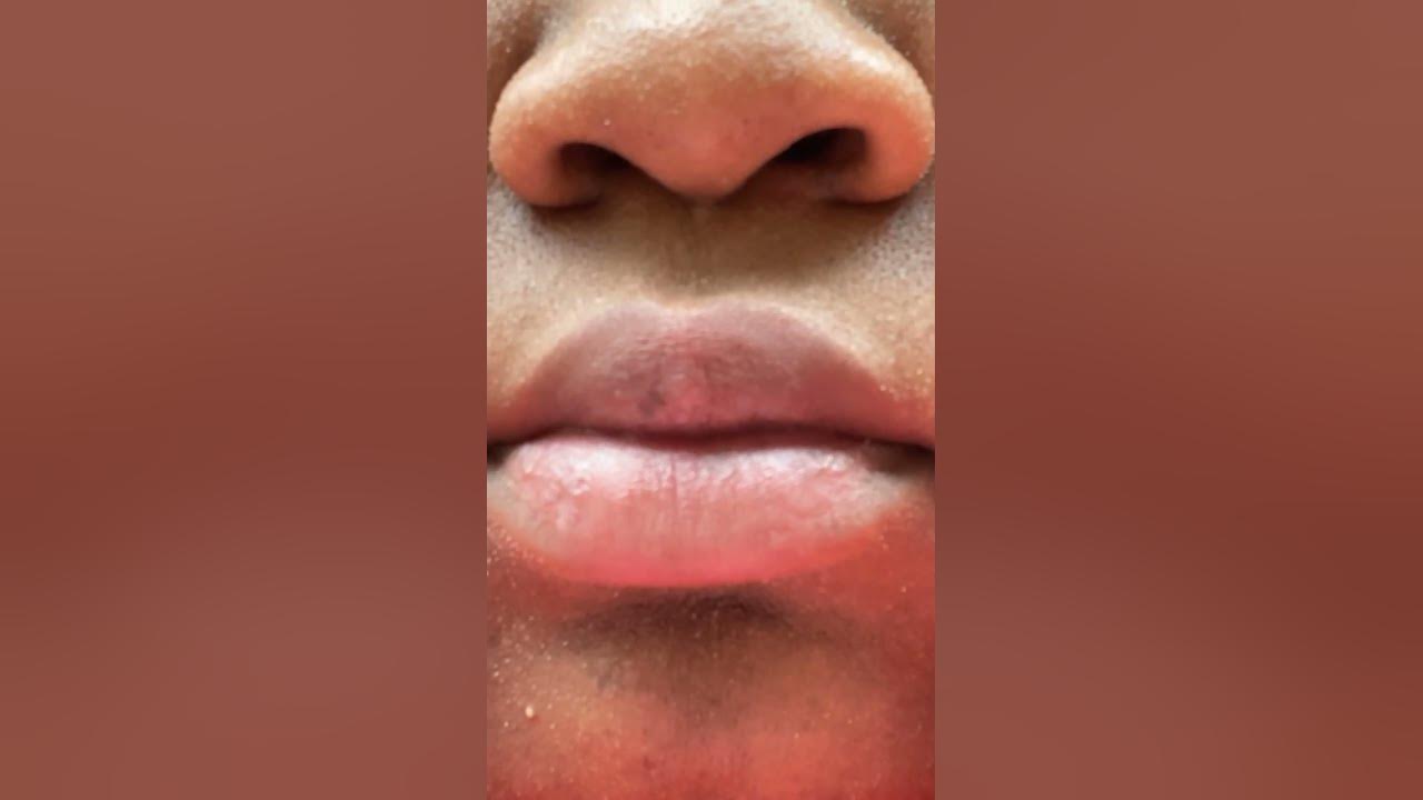 gabapentin lip twitching